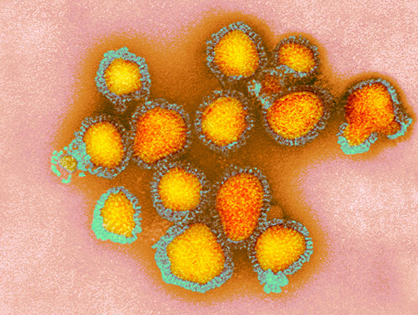 H3N2 Influenzavirus Particles Coloured Transmission Electron Micrograph — TEM